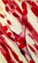 Fotografie cu capilare
 prin care globulele
 rosii trec in sir indian